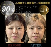 ビーワンセルフ(美.oneself)