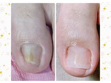 レル(L’aile)の雰囲気（変色巻き爪トラブル足爪もお任せください/菌バスター資格保有◎）