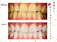 ホワイトニングショップ 武蔵小杉店の写真
