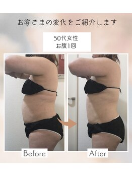 アンドユー(&U)/