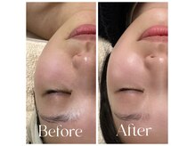 マグノリア(MAGNOLIA)の雰囲気（ララピールで即日水光肌！）