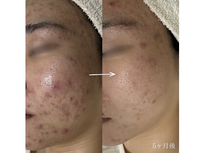 シェノン 赤坂大濠店の写真