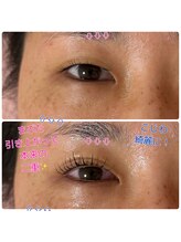 イズビューティー 足利(is Beauty)/アイパワーエステ