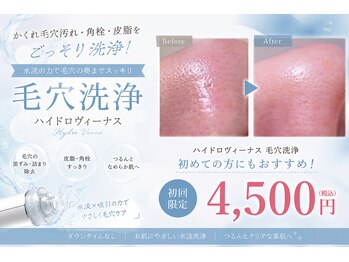 あすはれの写真/ハイドロヴィ-ナス"角質除去・毛穴洗浄"効果にこだわり◎毛穴洗浄でつるつる肌[築地/東銀座/毛穴/毛穴洗浄]