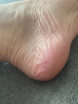 グリーングリーン(GREEN GREEN)/ドイツ式フットケア