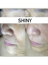 シャイニー(SHINY)/60代女性