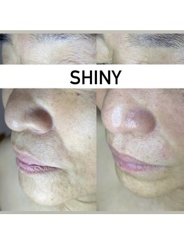 シャイニー(SHINY)/60代女性