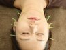 【眼精疲労/おでこのしわ緩和/エラ】美容鍼灸ヘッドスパ鍼60分7700円→3850円