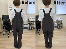 たぬきの山整骨院/育児で腰痛、肩こりがつらい