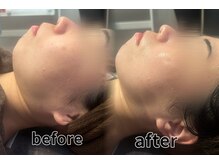 エスデザイン(es design)/小顔リンパマッサージ