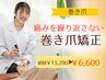【巻き爪】 痛みを繰り返さない矯正とセルフケア　初回￥13200→￥6600