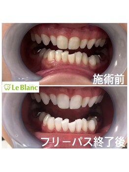 ルブラン 奈良店(Le Blanc)/皆勤賞の女性のお客様!