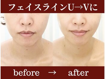 ガーデン(Garden)/【人気】リフトアップコース