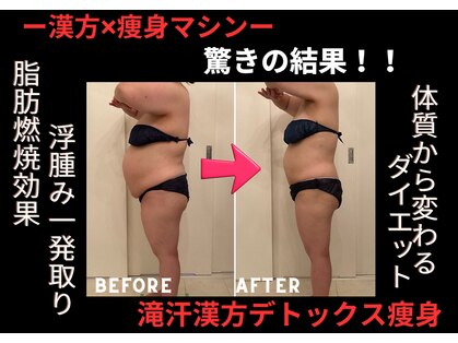 ソエルテ(soerute)の写真