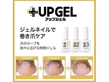 ミミ(mimi)/ジェルネイルで巻き爪ケア