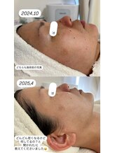 ウララカ(uraraca)/どんどん変わっていく！