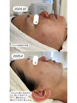 ウララカ(uraraca)/どんどん変わっていく!