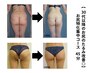 【30代以降の“お尻のたるみ“改善◎】お尻特化集中コース45分