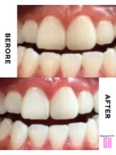 エクシアホワイトニング 王寺店/