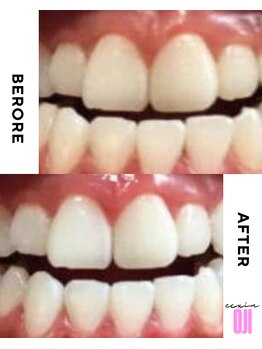 エクシアホワイトニング 王寺店/