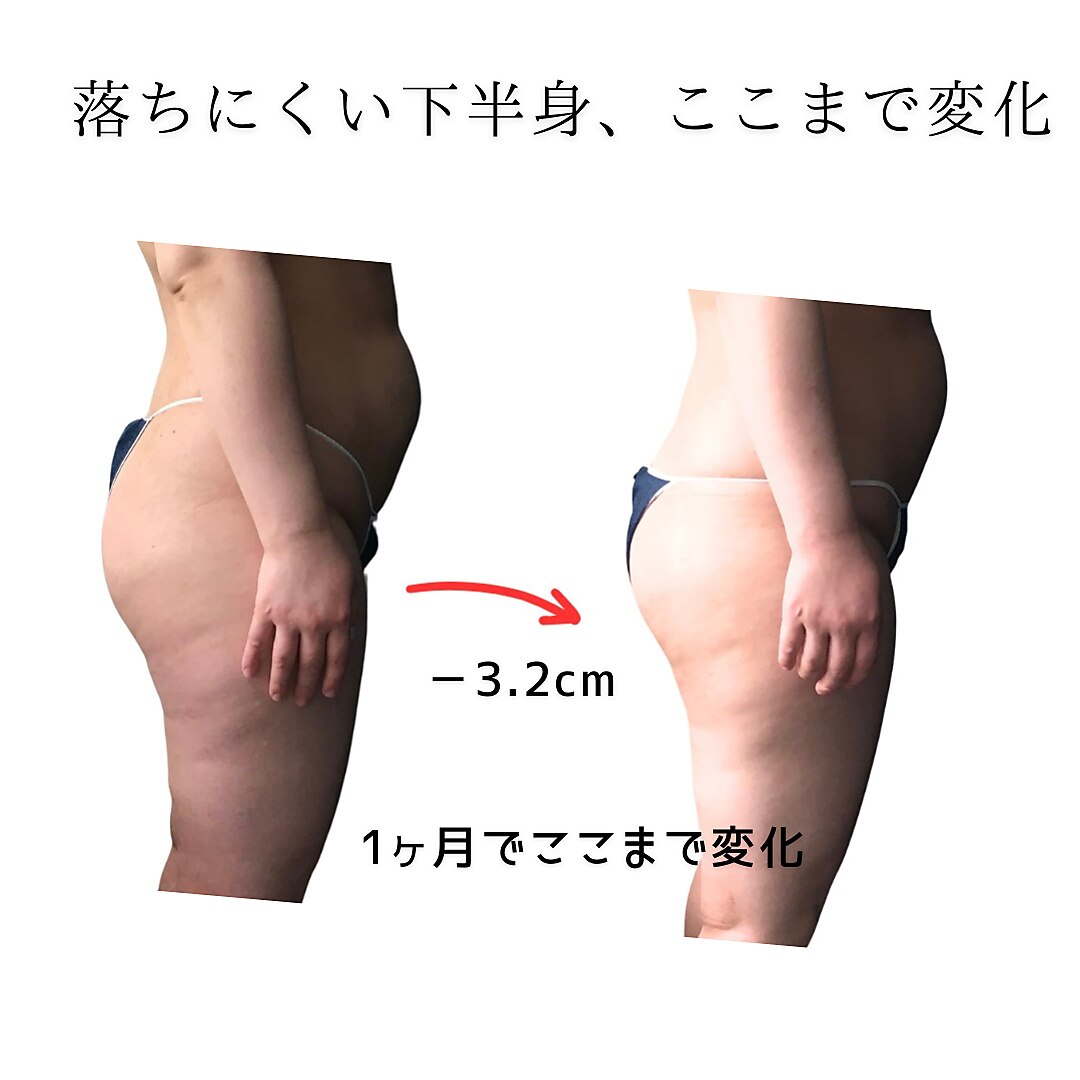 ネオボディ(Neo Body)｜ホットペッパービューティー