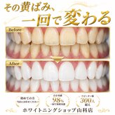ホワイトニングショップ 山科店