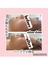 サロンシャイン(Salon Shine)/REVI]ハーブ２０代男性