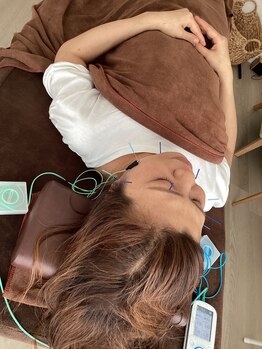 ハリファ鍼灸院 横浜関内院(HariFa鍼灸院)/美容施術