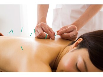 りっつ鍼灸院/鍼灸歴20年！頑固なコリに！