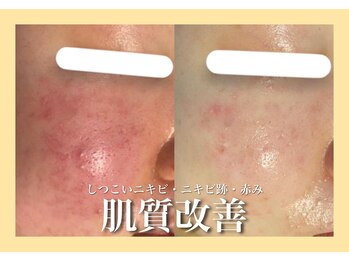 メリー 大和西大寺店(merry)