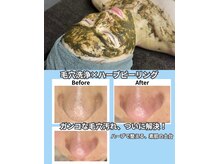 脱毛マックス 南越谷店(MAX)