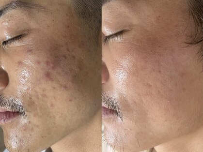 ナポデイズ(NAPODAYS)の写真