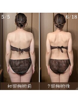 ルマ(Rumah)/骨格は凝りで変わります