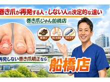 巻き爪じゅん 船橋店/再発しやすい人の特徴をご紹介。