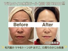 プティ カシェット 伊丹店(petit cachette)