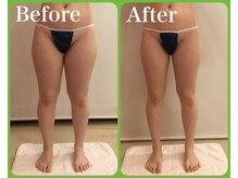 クイーン 熱海店(Queen)/足をホッソリ！