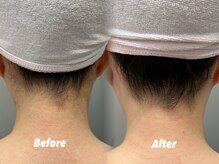 クイーン 渋谷店(QUEEN)/見せたくなる美しいうなじ