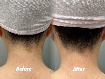 クイーン 渋谷店(QUEEN)/見せたくなる美しいうなじ