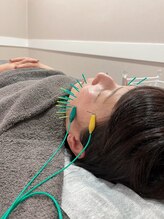 ヴィーライン 大阪梅田院(VeLine)/鍼灸／美容鍼／小顔／大阪／梅田