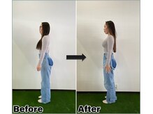 ビーボディ 整体院(B-body)/反り腰でお悩みの方