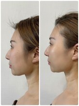 メディカルエース(MedicalAce)/看護師ハイサーマ