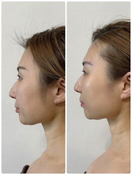 メディカルエース(MedicalAce)/看護師ハイサーマ