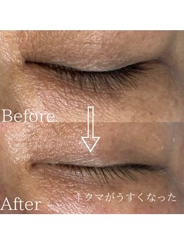 サロンディア(SALON Dea)/施術効果