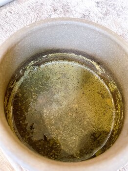 あんどら鍼灸接骨院/漢方蒸し後の壺