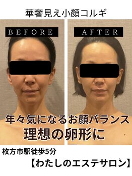 わたしの 大阪枚方本店/年々気になるお顔の長さ大きさ