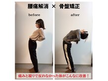 猫背や巻き肩など姿勢が気になる学生さんもお待ちしております◎