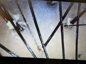 マイントゥー(mine too)/リスクを少なく!