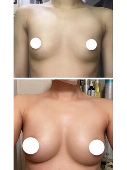 スマイルクルー(SmileClue)/ビフォーアフター症例