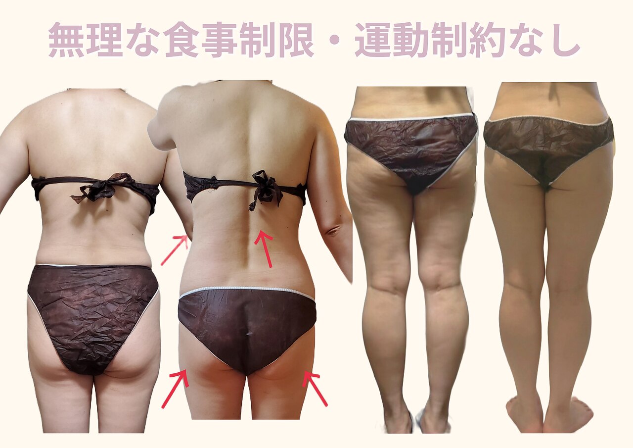 ヨサパーク リノ(YOSA PARK Lino)｜ホットペッパービューティー