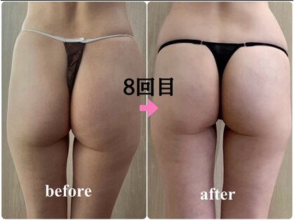 バービーグロウ 恵比寿(Barbie Glow)の写真